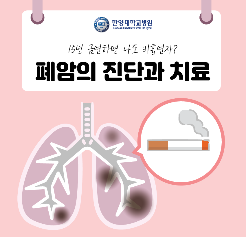 15년 금연하면 폐암 발생률 비흡연자와 비슷?!